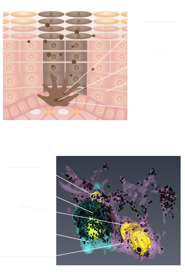 一般的な模式図と3D解析 比較図