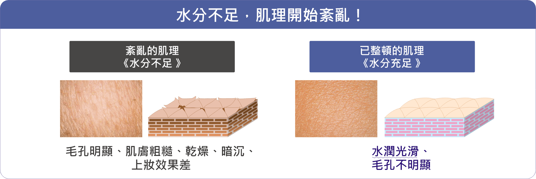 水分不足で、キメは乱れ始める!