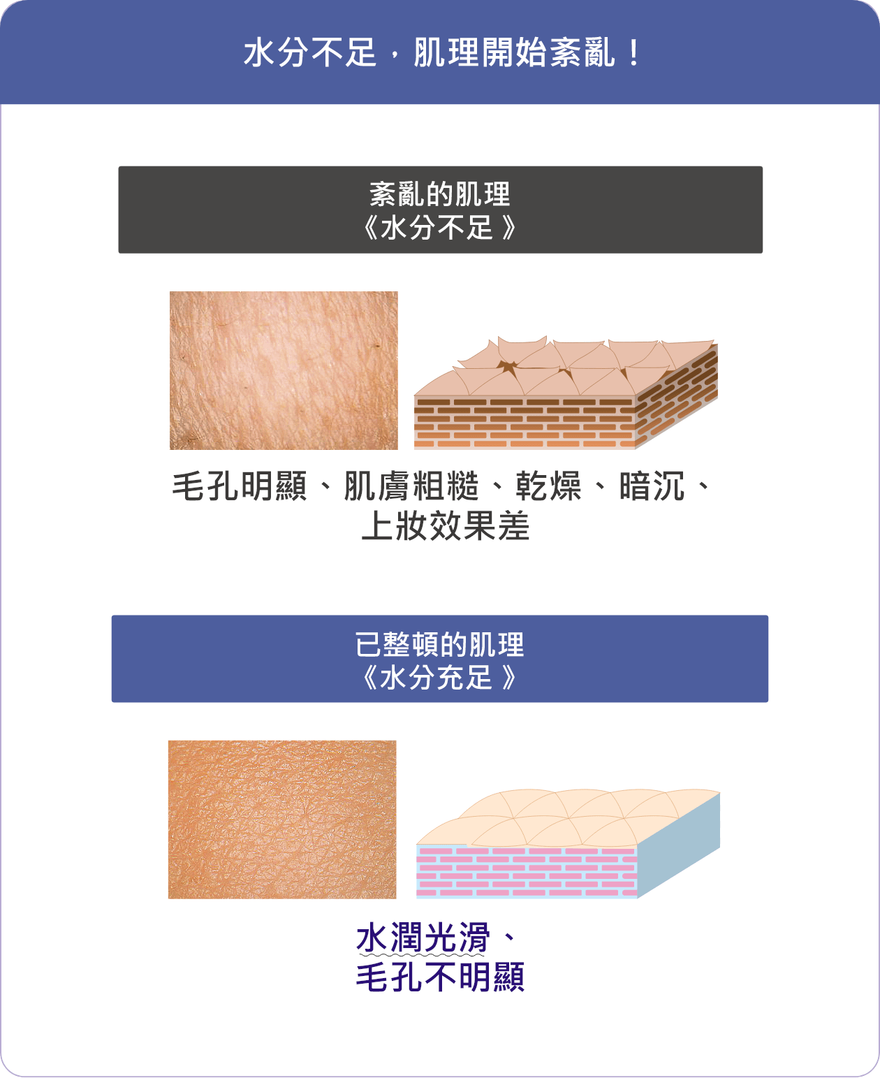 水分不足で、キメは乱れ始める!