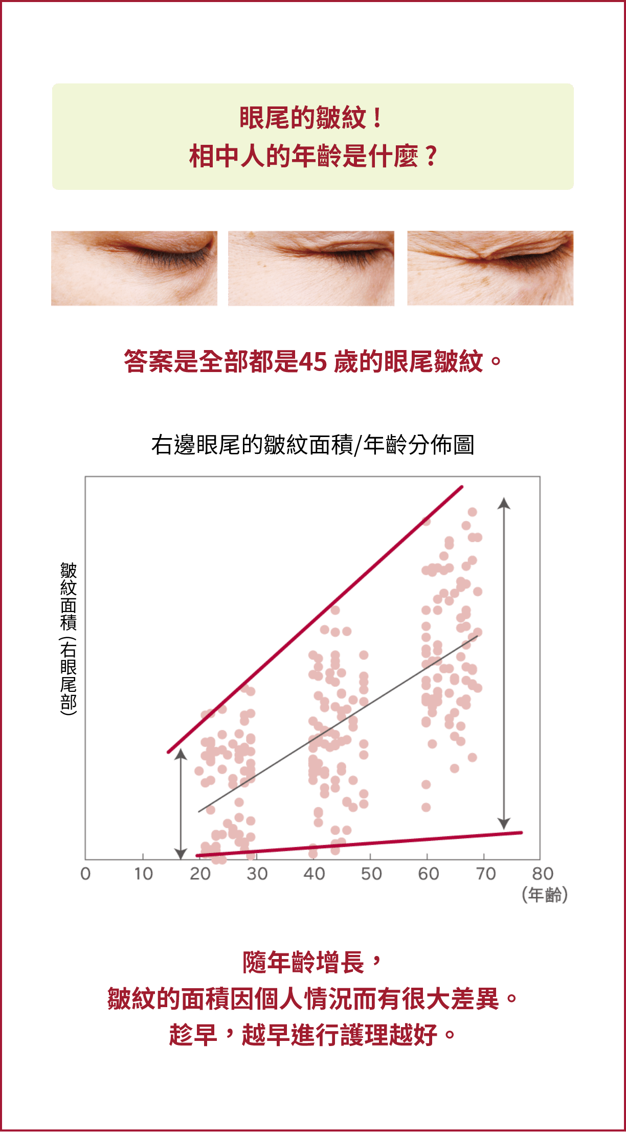 年齢が上がるとともに、シワの個人差は大きくなります。早め、早めのケアが大切です。