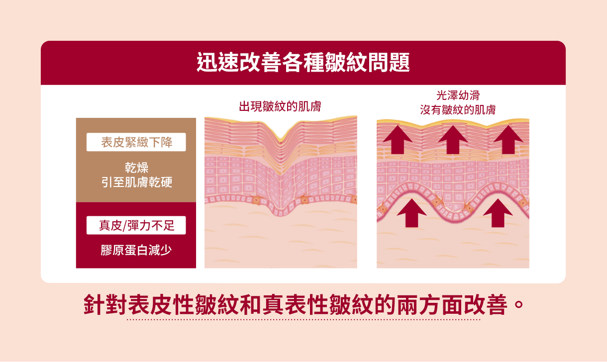 あらゆるシワ悩みを、速攻ケア